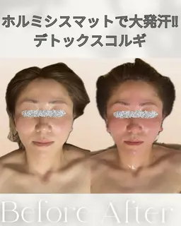 【Open記念価格】小顔コルギ✨小顔定着石膏パック&デコルテ肩首背中リンパ付き✨