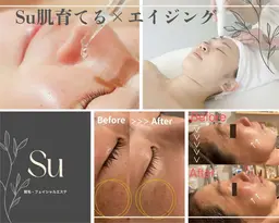 【限定5名様】モニターご協力でワンコインエステ♪