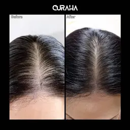 韓国最新育毛/頭皮改善/メンズ必見