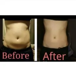 コルギ(顔、デコルテ、肩甲骨)×お腹ハイパーナイフ×石膏パック 施術時間95分