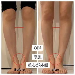 【美脚矯正】O脚・膝下の歪み改善へ✨骨格×筋膜ケアで整える体感コース