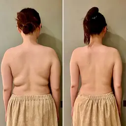 ファシアストレッチ《ウエスト腸ほぐし》【60分】