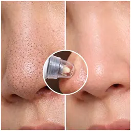 毛穴吸引＆超音波洗浄＆マッサージ