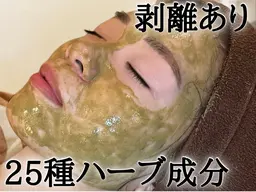 ★新規｜人気No.1肌質改善ニキビケアコース★ハーブピーリング《施術５STEP》