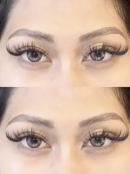 ハリウッドブロウリフト