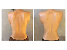 【女性限定🌹肩​〜​腰の背中】たるみ贅肉おさらば！セルライト集中ケアand保湿ケア