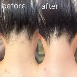 【学割U24✨】うなじ+背中上光脱毛【ミニモ学割】