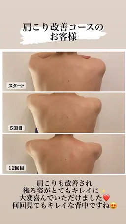 辛い肩こりバイバイコース　30分