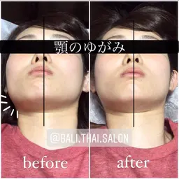 【期間限定】ミニモ学割＆モニター割！【顎の歪み体験コース】カイロプラクティック