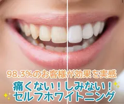 【1日1名様限定】Google口コミご協力クーポン！短期的に白くしたい方へ！ハイパワーホワイトニング10分✖️3照射✨