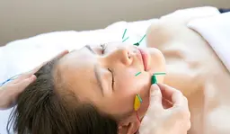 【フェイス特化】電流美容鍼+ヘッドマッサージ付