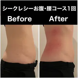 【ビフォアフ撮影モデル🤳🏻💖】シークレシー ×リンパマッサージ 部分集中60分⚡️