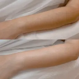 【ワックス脱毛-Ｌパーツ】