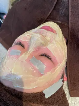 【ご新規様🉐】マツヤニパック全顔コース🍯つるんとゆで卵肌に✨️産毛、お口周りなど濃い毛を徹底的に除去🔥