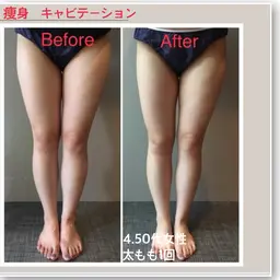 ダイエットしてても体重が落ちにくい方に痩身!体験お試しプラン20分口コミ書いてくれる方のみ✨