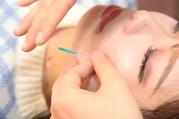 【少ない刺激で小顔効果🌟】美容鍼＋首肩のマッサージ