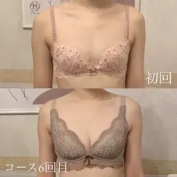 【デコルテの隙間・下垂・産後授乳後のお悩み改善】バストケア