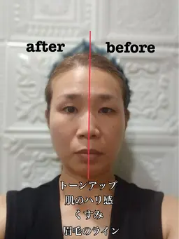 【人気No.1】✨フェイシャルワックス〈顔＋首＋デコルテ〉✨