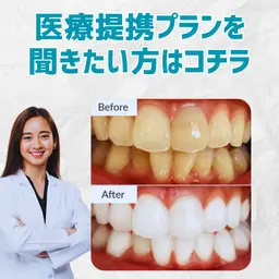 プランを聞きたい方【プランお申込で医療提携ホワイトニング初回当日無料】