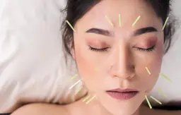 【　⭐︎Beauty  鍼灸　120分　】