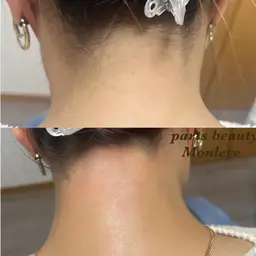 うなじワックス