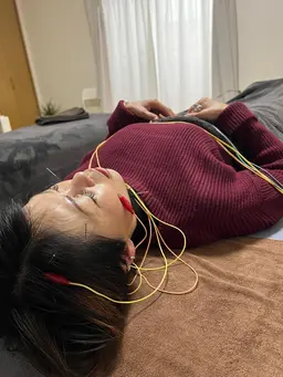 【電気を流す美容鍼】お顔がゆるふわ・素敵な笑顔でマスクなしでも安心☺️