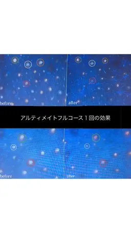 毛穴洗浄徹底コース🧹✨️  〈画像診断付き〉