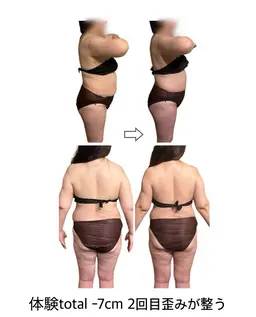 💎初回体験💎骨盤歪み整える美容整体