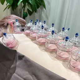 鍼施術(全身)＋パルス(電気鍼)＋吸玉(カッピング)+マッサージ