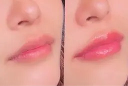 メラニンケア⭐️LALA PINKモニター(リップ)