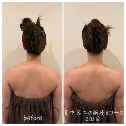 二の腕&背中痩せ45分【5回コース】