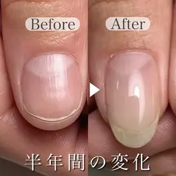 ◎どれを選んだら良いかわからない方はこちら✔️自爪育成スタート