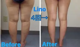 🌈ご新規様🌈キャビ痩身マシン+全身リンパ+ヘッドスパ90分7980円