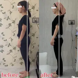 ＂今だけ半額＂【スタンダード｜肩・首周り矯正】ガチガチ首肩に！猫背・巻き肩・ストレートネック改善◎