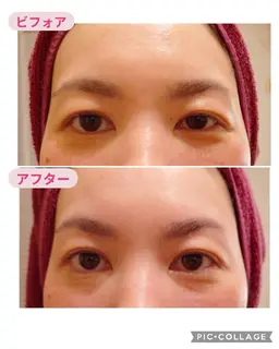 【速攻リフトUP】ナノカレント深層ヘッドマッサージ×かっさ★頭・首肩 45分