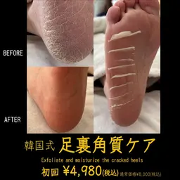 当日予約🆗韓国式🇰🇷足裏角質ケア メンズも可‼️