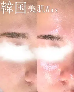《毛穴汚れ・ざらつき撃退》美肌フェイシャルwax✨
