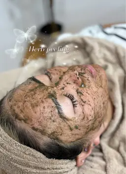 【新規open】ハーブピーリング(剥離あり)［クレンジング+洗顔+鎮静化粧水+クリーム付き］