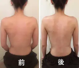 【ブライダルおすすめ】小顔矯正コルギボディエステ100分コース