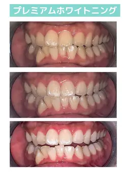 【期間限定メニュー】何と!会員級の合計60分照射!【2来店コース】