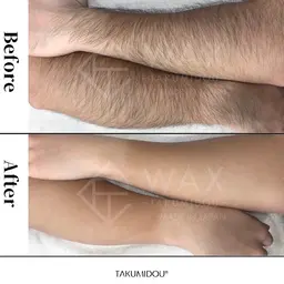 🩵男性WAX★腕全体すっきりケア🩵腕allで清潔感アップ⤴️✨️