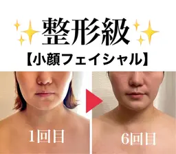 【たるみ／毛穴／食いしばり解消】エラ張り食いしばり小顔フェイシャル60分◎