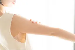 美肌脱毛 両腕のみ