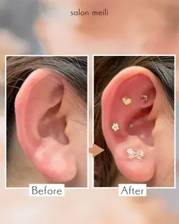 耳つぼジュエリー12粒💎