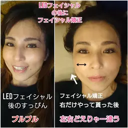 頭蓋骨からアプローチ、浮腫みを流しその場で橋⚪︎環七‼️実感✨美Dical式小顔矯正✨