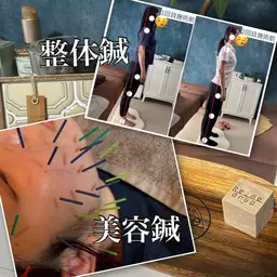 minimo限定SALE❤️🔥【トータルケア】整体鍼+美容鍼で頭の先〜足の先までスッキリ✨