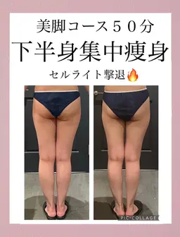 【初回限定】痛いからこそ効く頑固なセルライトとさよなら、脚痩せ50分コース⭐︎