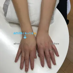 ご褒美ハンドエステ