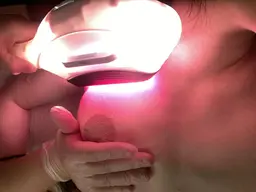 10代の【美療全身脱毛】健肌効果の美肌力＆短期完了のお得さで年間1000名