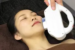 顔脱毛　1回３４００円